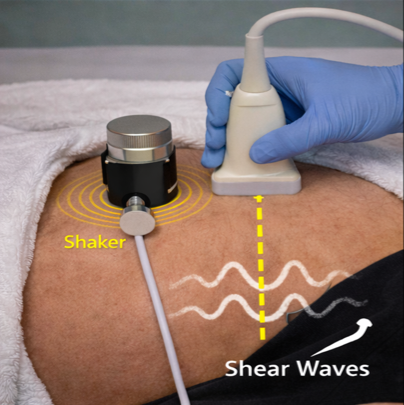 Time-harmonic elastography imaging illustration